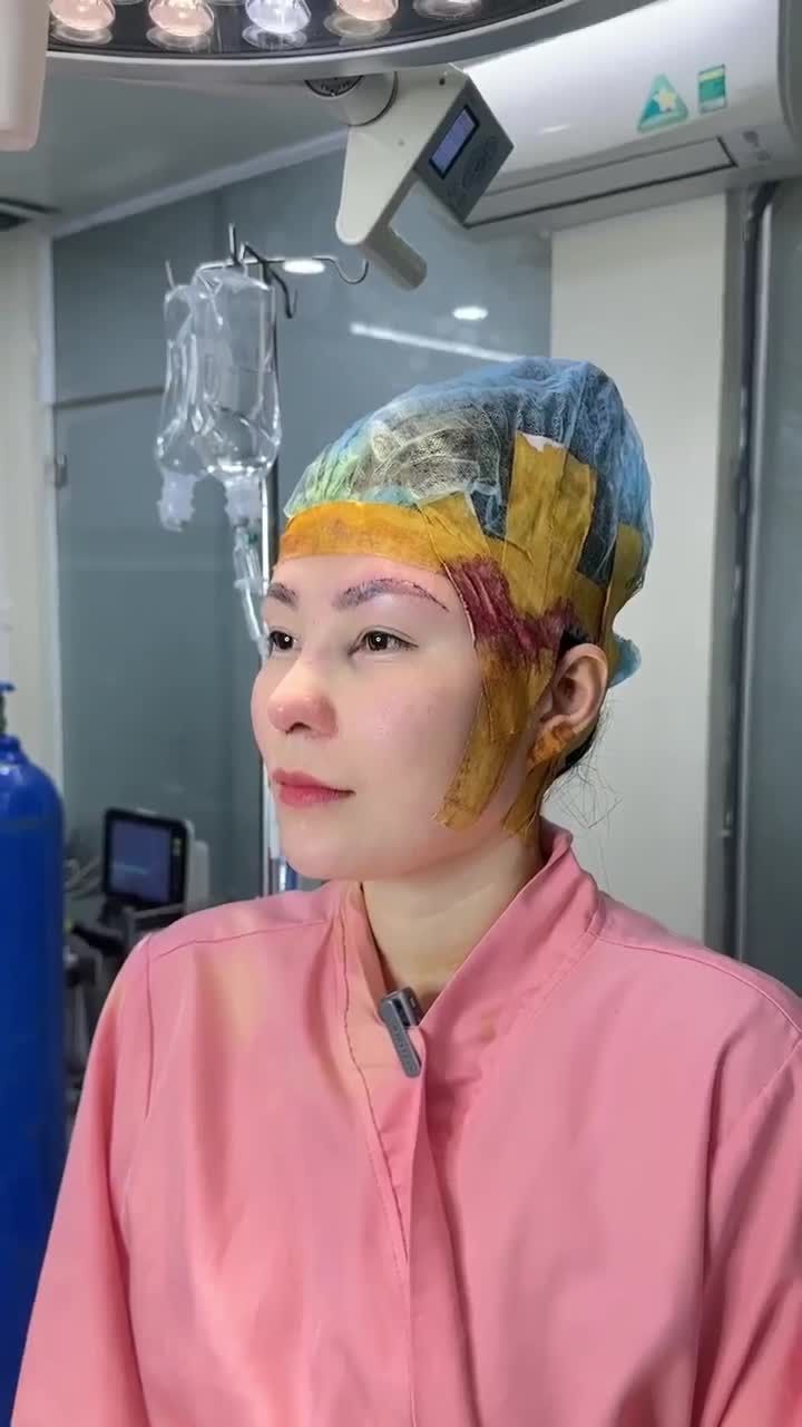 KẾT QUẢ NÂNG MŨI CẤU TRÚC + TREO CUNG CHÂN MÀY | KH. HUỲNH NHƯ (SÓC TRĂNG)