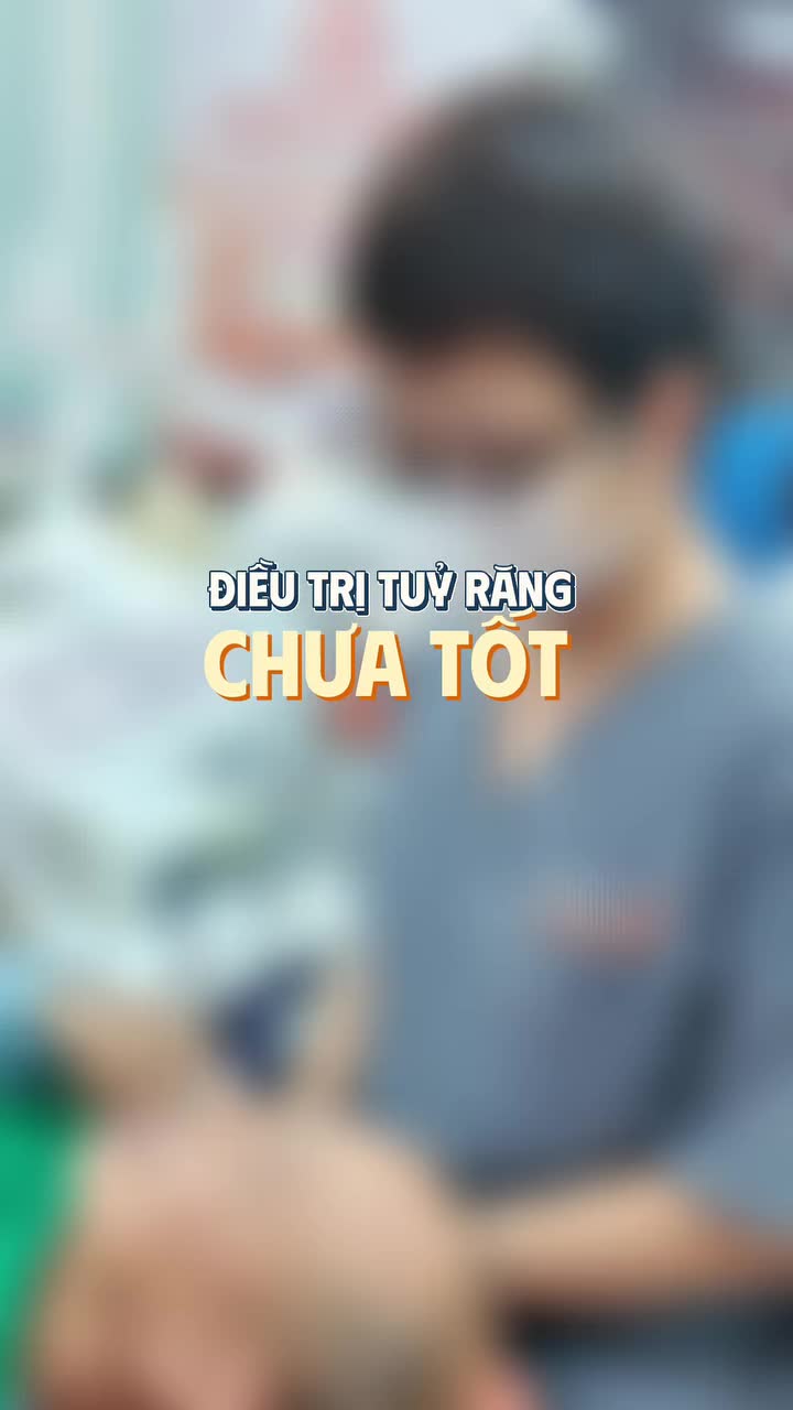 RĂNG VẪN Ê BUỐT SAU ĐIỀU TRỊ TUỶ?