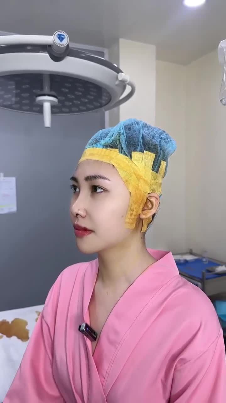 KẾT QUẢ NÂNG MŨI CẤU TRÚC DR.HOẠT CHO EM KHÁCH HÀNG GENZ  KH. MINH NGỌC