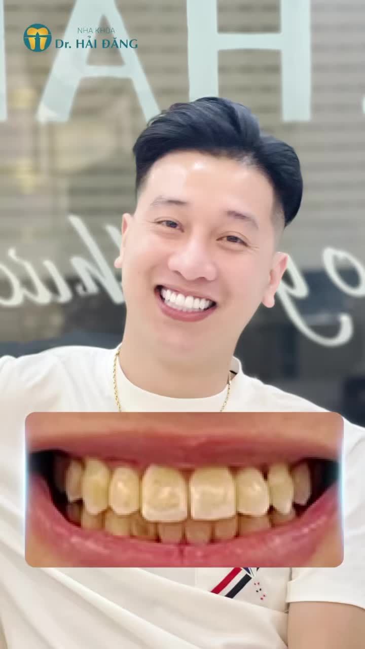 Bạn đang tìm kiếm một giải pháp để có nụ cười đẹp, tự tin hơn mỗi ngày ???