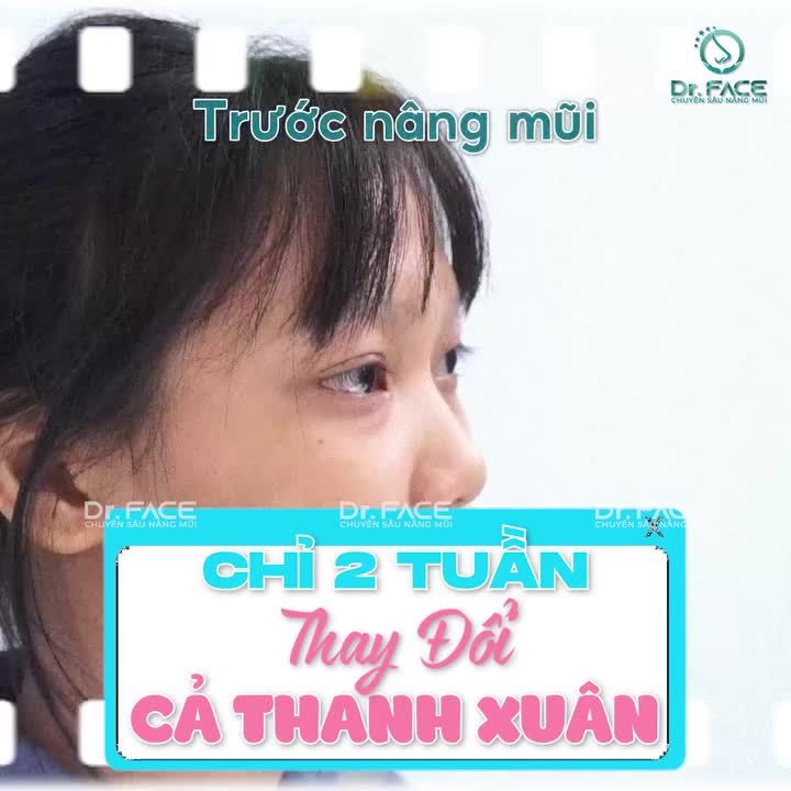 CHỈ 2 TUẦN THAY ĐỔI CẢ THANH XUÂN