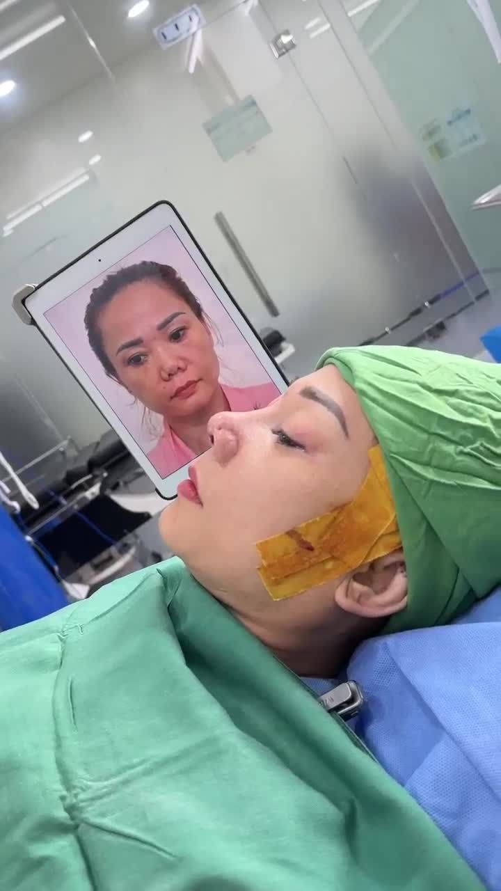 TRẢ KẾT QUẢ SỬA LẠI MŨI HỎNG