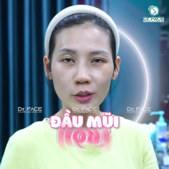 ĐẦU MŨI TRÒN MỀM THÍCH LẮM CÁC BẠN ƠI!”