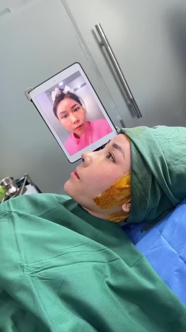 KẾT QUẢ NÂNG MŨI CẤU TRÚC - SỬA LẠI MŨI HỎNG  KH. NGUYỄN T.HUYỀN (CẦN THƠ)