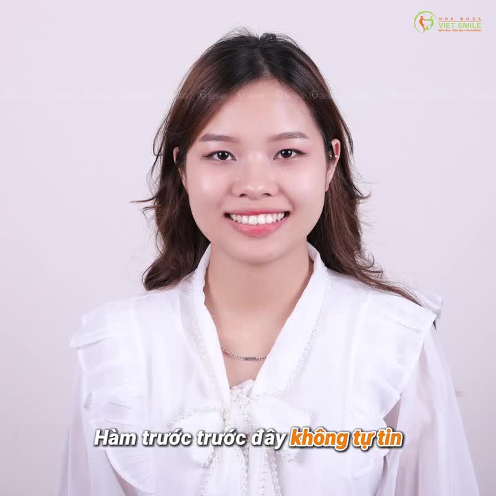 Niềng răng xong "HỐI HẬN"  Hối hận vì không niềng sớm hơn