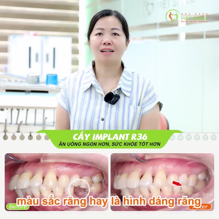Từ lời giới thiệu – Đến trải nghiệm trọn vẹn tại Viet Smile