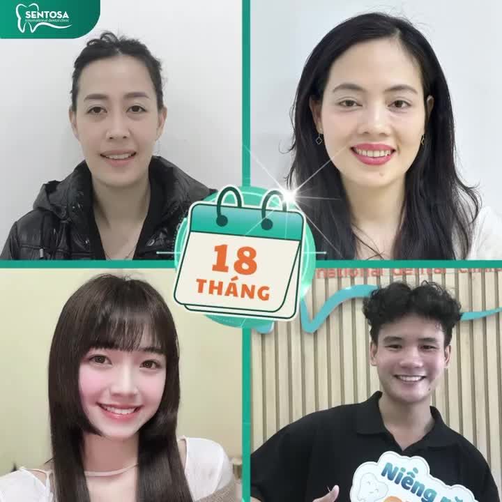 TỐI ƯU HIỆU QUẢ NIỀNG RĂNG VỚI INVISALIGN KẾT HỢP PHẦN MỀM 3D CLINCHECK