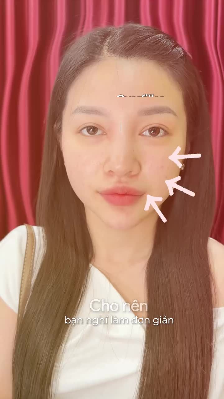 Muốn cải thiện hoàn toàn khuyết điểm mũi, lên dáng mũi theo đúng mong muốn và giữ được hiệu quả thẩm mỹ lâu dài thì chỉ có phương pháp phẫu thuật nâng mũi mới đáp ứng được thôi nha các bạn!!!