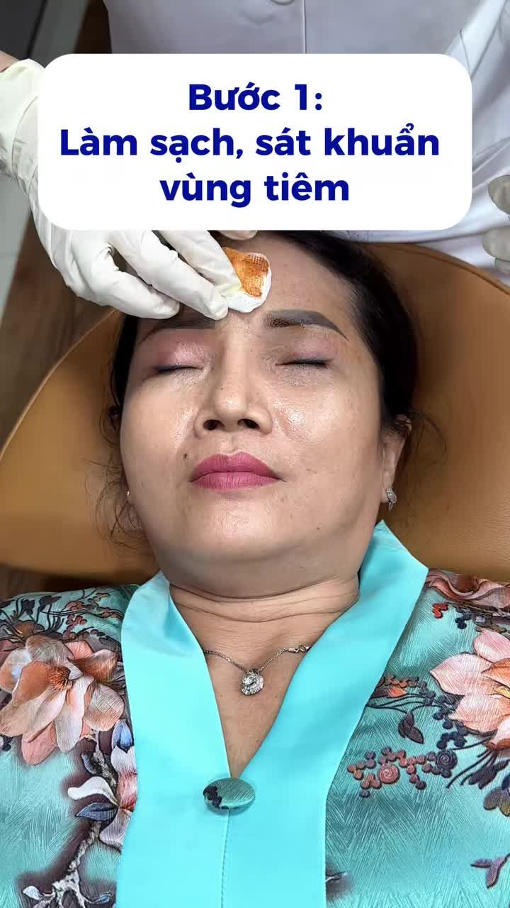 Tiêm botox xóa nhăn trán gì chưa người đẹp?