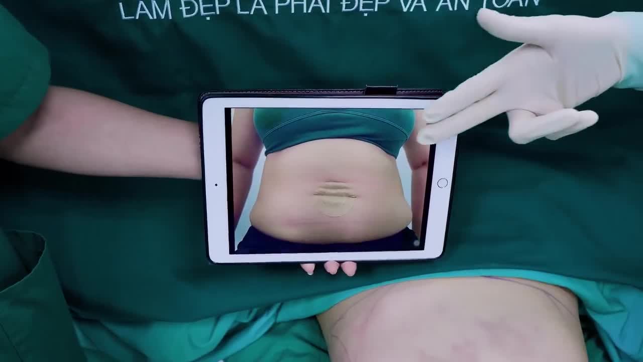 Trăm lời quảng cáo cũng không bằng tận mắt chứng kiến kết quả thật.
