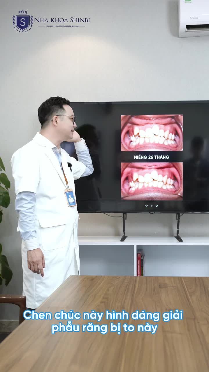 NIỀNG RĂNG CHỈNH NHA: HIỆU QUẢ CAO – CHI PHÍ PHÙ HỢP