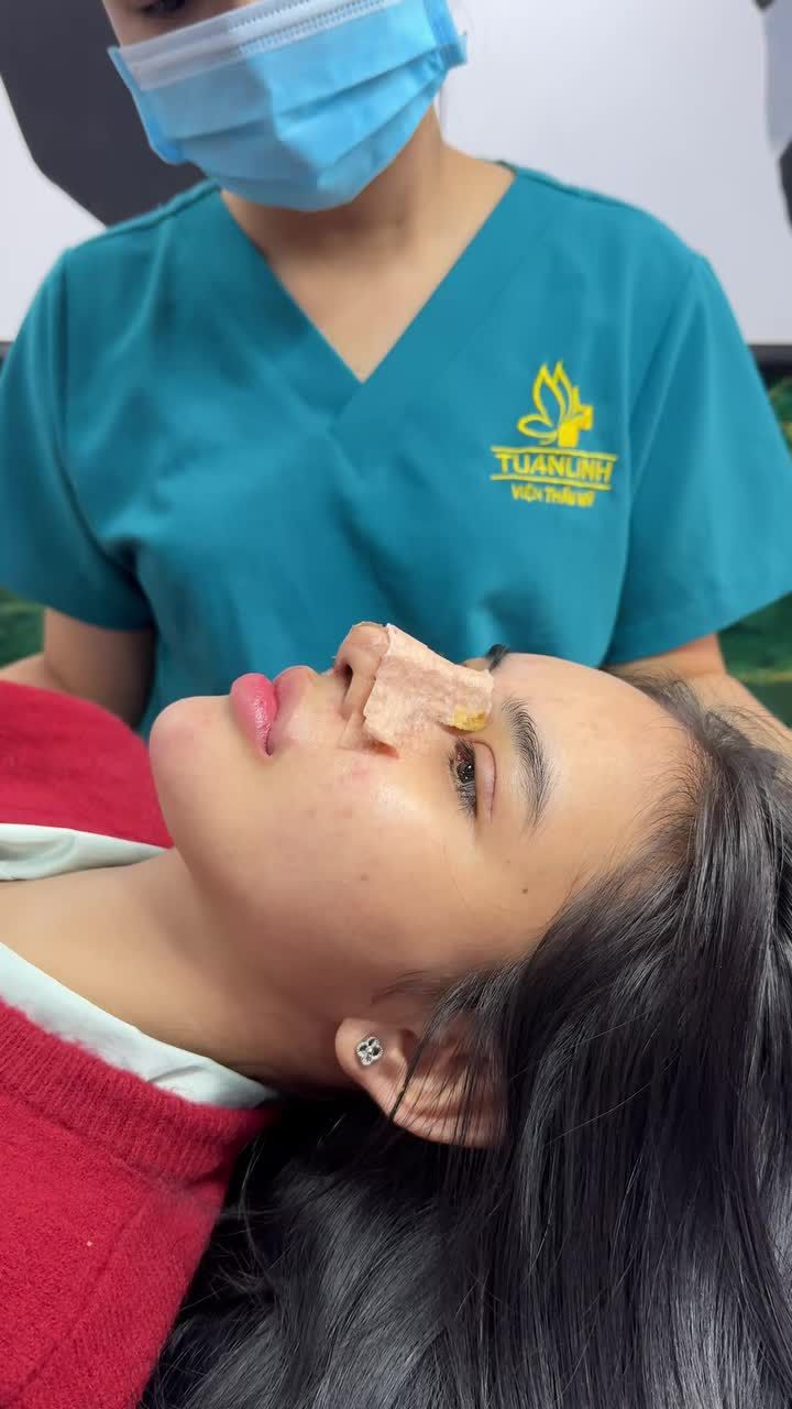 Case cấu trúc sửa lại được 10 ngày