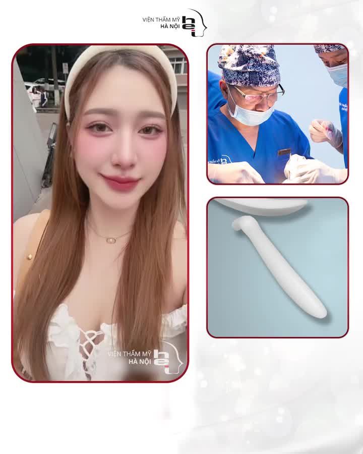 NÂNG MŨI BELLA SILK 5S