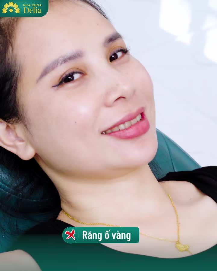 Cảm ơn chị Nguyễn Thị Yến ( đến từ Thanh Hóa) đã lựa chọn Delia bọc 20 răng sứ Lava Plus