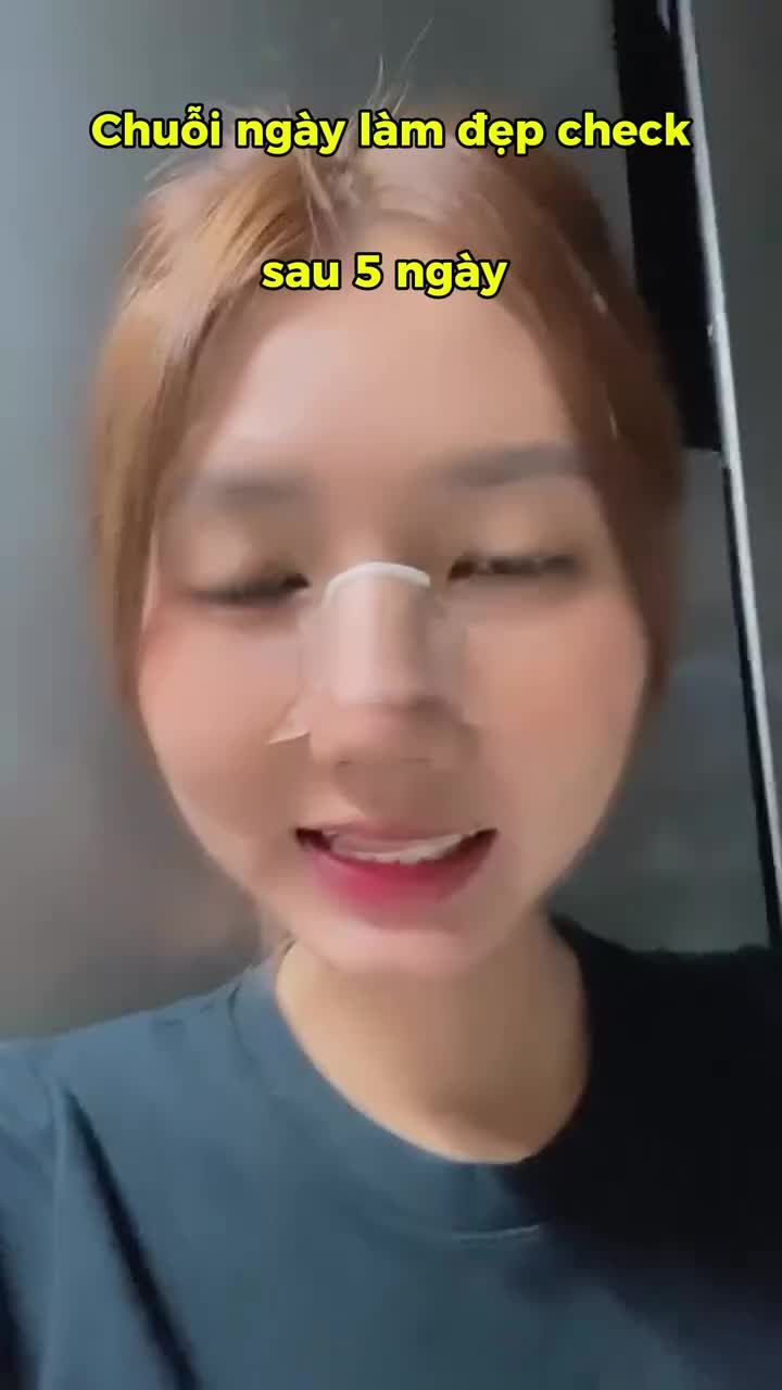 AI TỪNG NÂNG MŨI CŨNG MONG ĐỢI NHẤT KHÚC NÀY