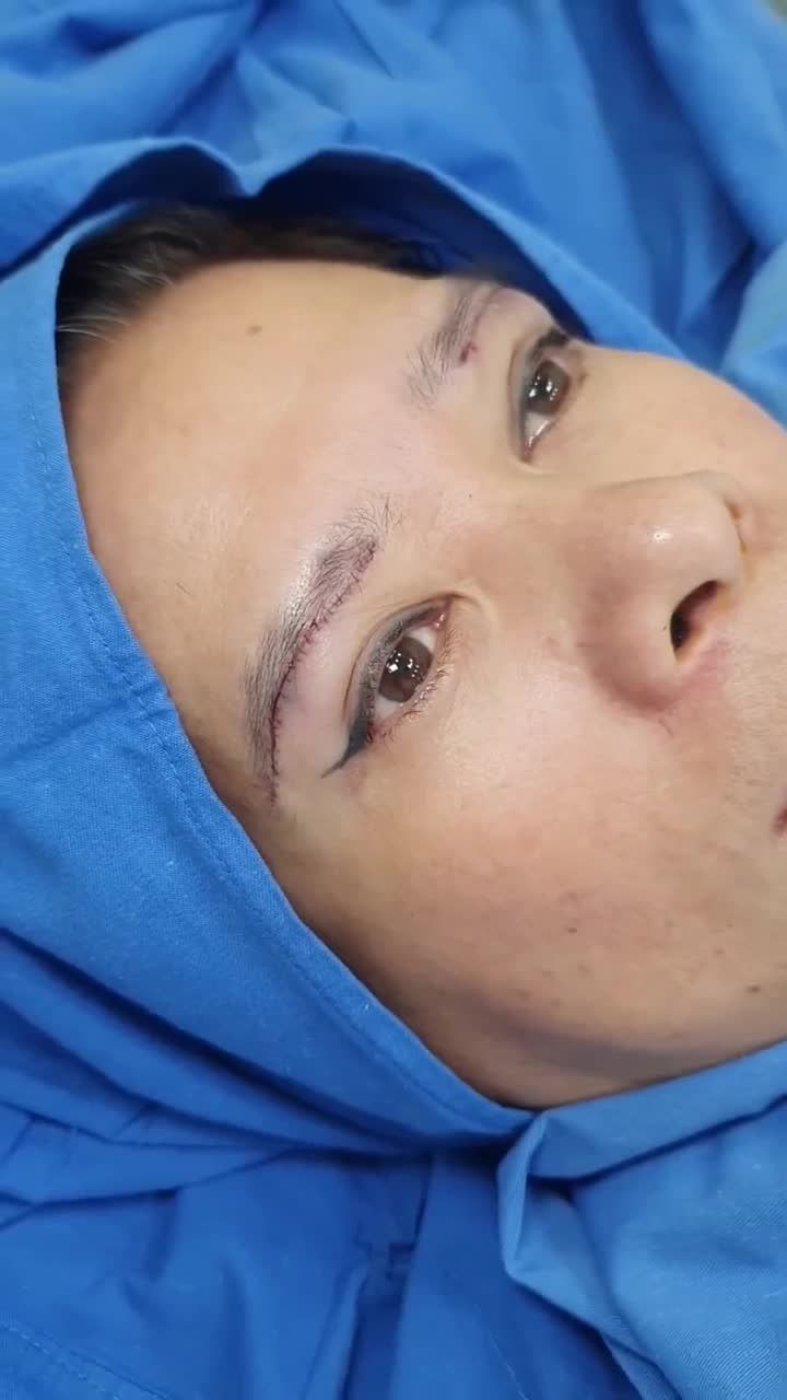 TREO CUNG MÀY- ĐẸP NGAY SAU BÀN TAY BÁC SĨ KỲ