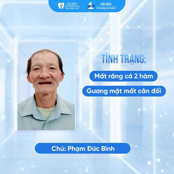 TOP 3 HÀNH TRÌNH "HỒI SINH NỤ CƯỜI" ẤN TƯỢNG TẠI NHA KHOA ATHENA
