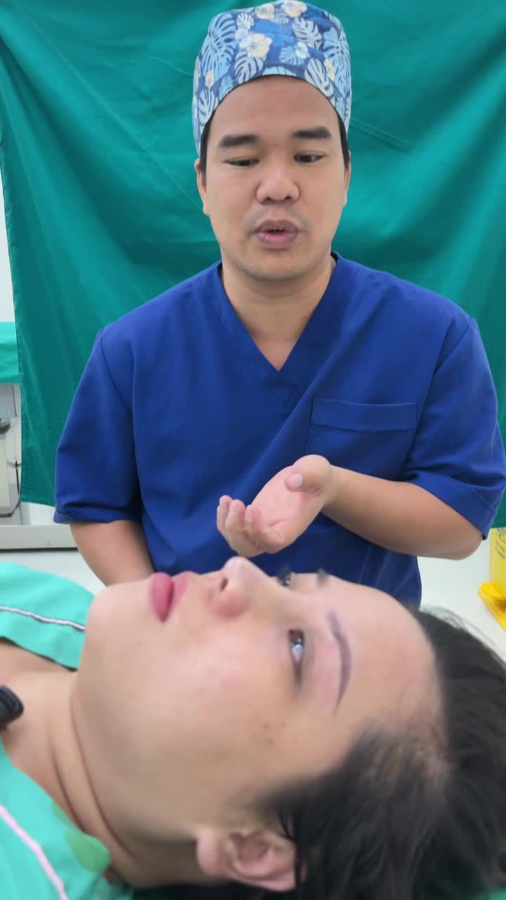 Case mũi bọc sụn vừa hoàn thành!!