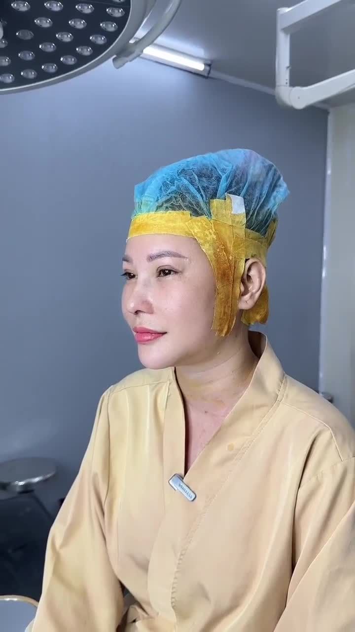 90 PHÚT NÂNG MŨI CẤU TRÚC + ĐỘN CẰM V-LINE KH. DIỄM HỒ