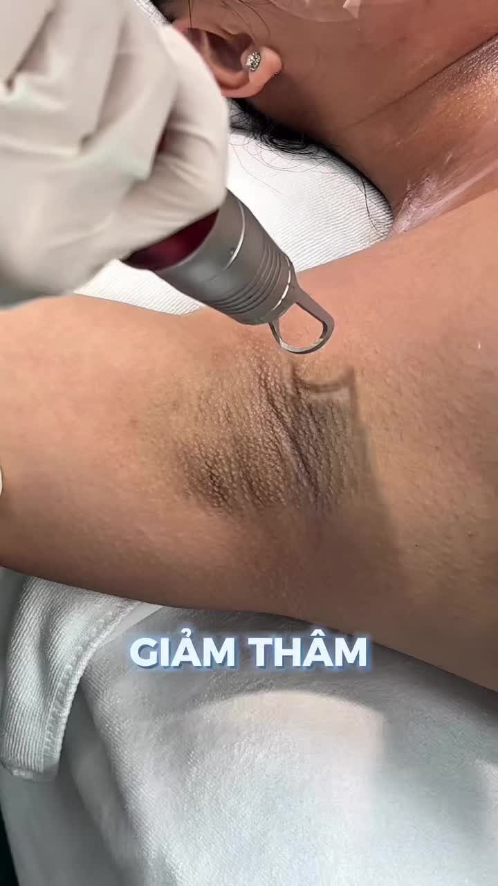 LÀM ĐẸP ĐÓN HÈ SANG – TỰ TIN KHOE DA SÁNG MỊN DƯỚI CÁNH TAY