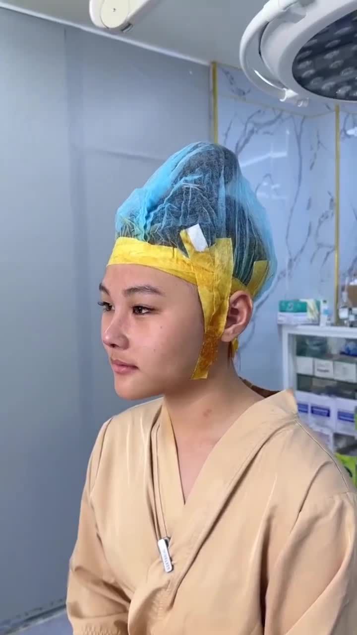 BÁC SĨ HOẠT THÀNH CÔNG NÂNG MŨI CHO BẠN KHÁCH 2K6 ĐẾN TỪ MỸ