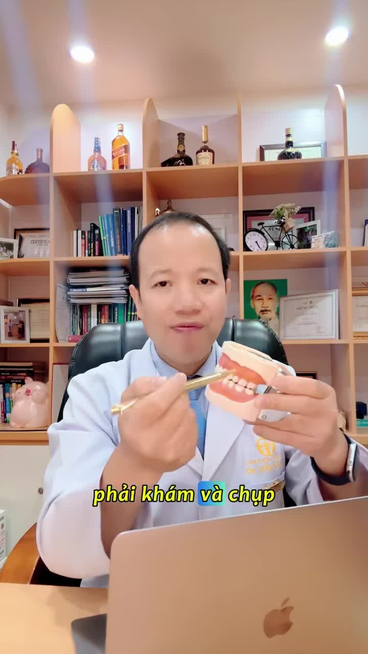 LƯU Ý QUAN TRỌNG KHI LỰA CHỌN  RĂNG SỨ