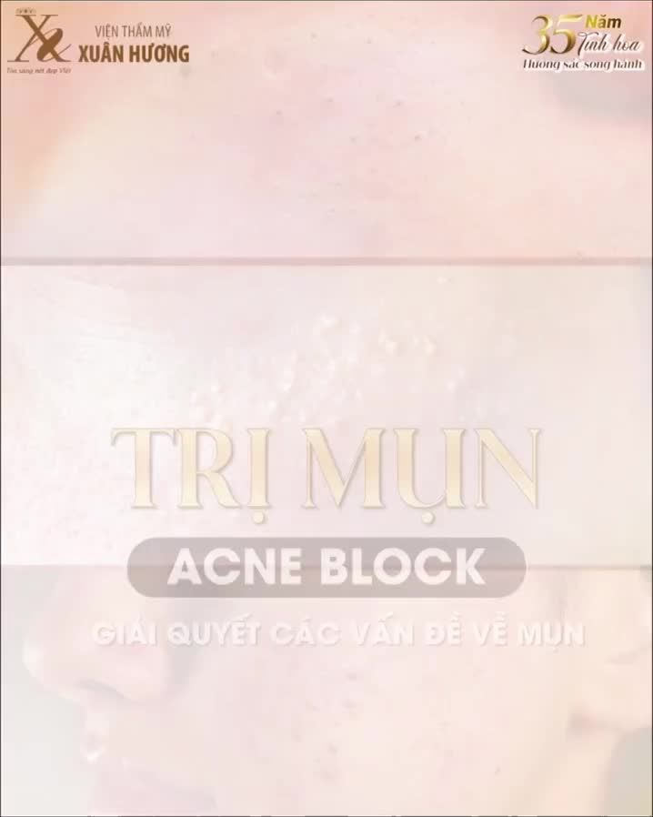ACNE BLOCK – GIẢI PHÁP ĐIỀU TRỊ MỤN CHUYÊN SÂU CHUẨN Y KHOA