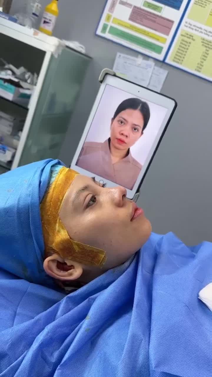 SIÊU PHẨM NÂNG MŨI CẤU TRÚC SAU 60 PHÚT THỰC HIỆN BỞI EKIP BÁC SĨ HOẠT