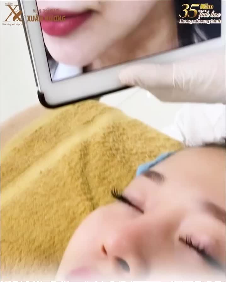 TRỊ TÀN NHANG BẰNG LASER – CÓ THẬT SỰ CHỈ MẤT MỘT BUỔI?