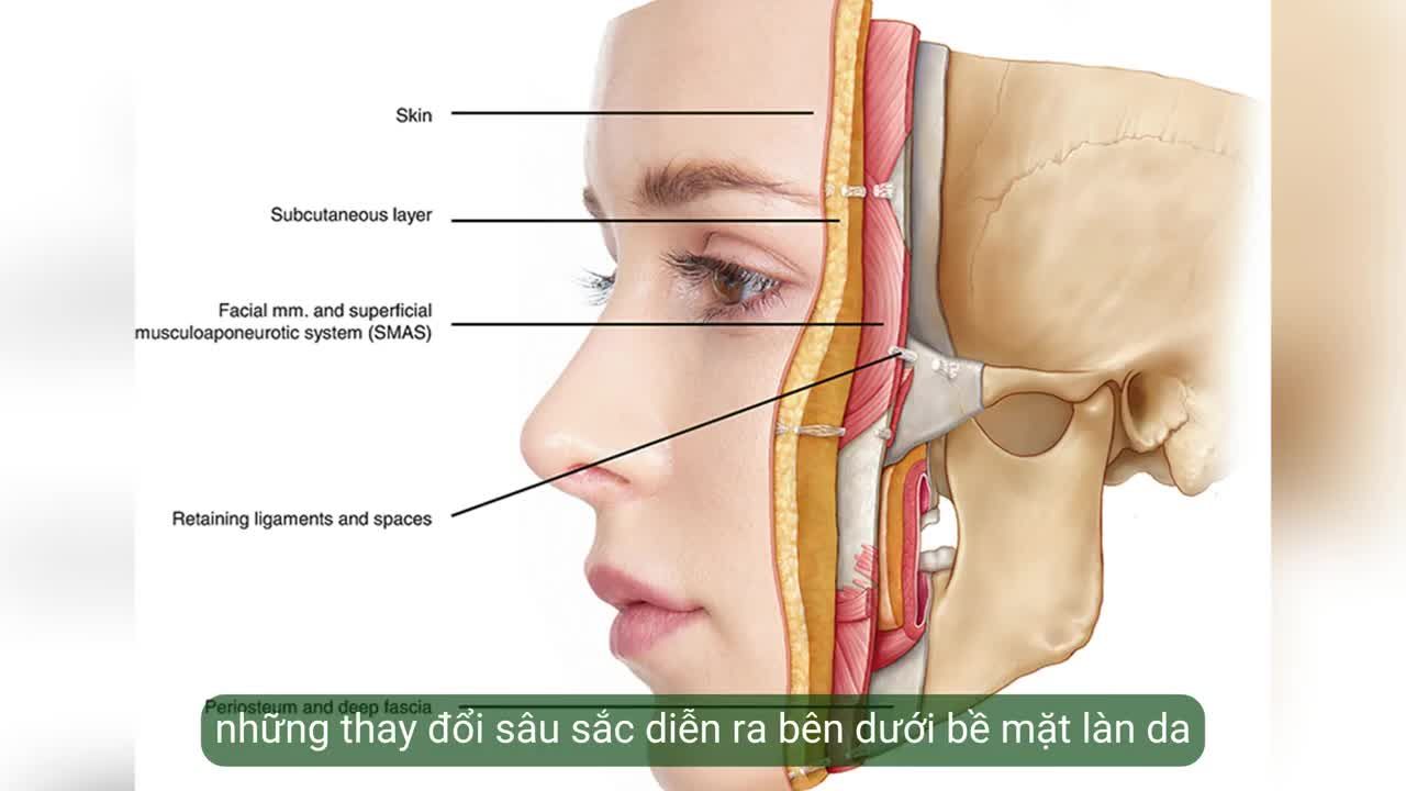CĂNG DA MẶT DEEP PLANE FACELIFT – ĐỈNH CAO TRẺ HÓA TỰ NHIÊN KHÔNG ĐỂ LẠI DẤU VẾT