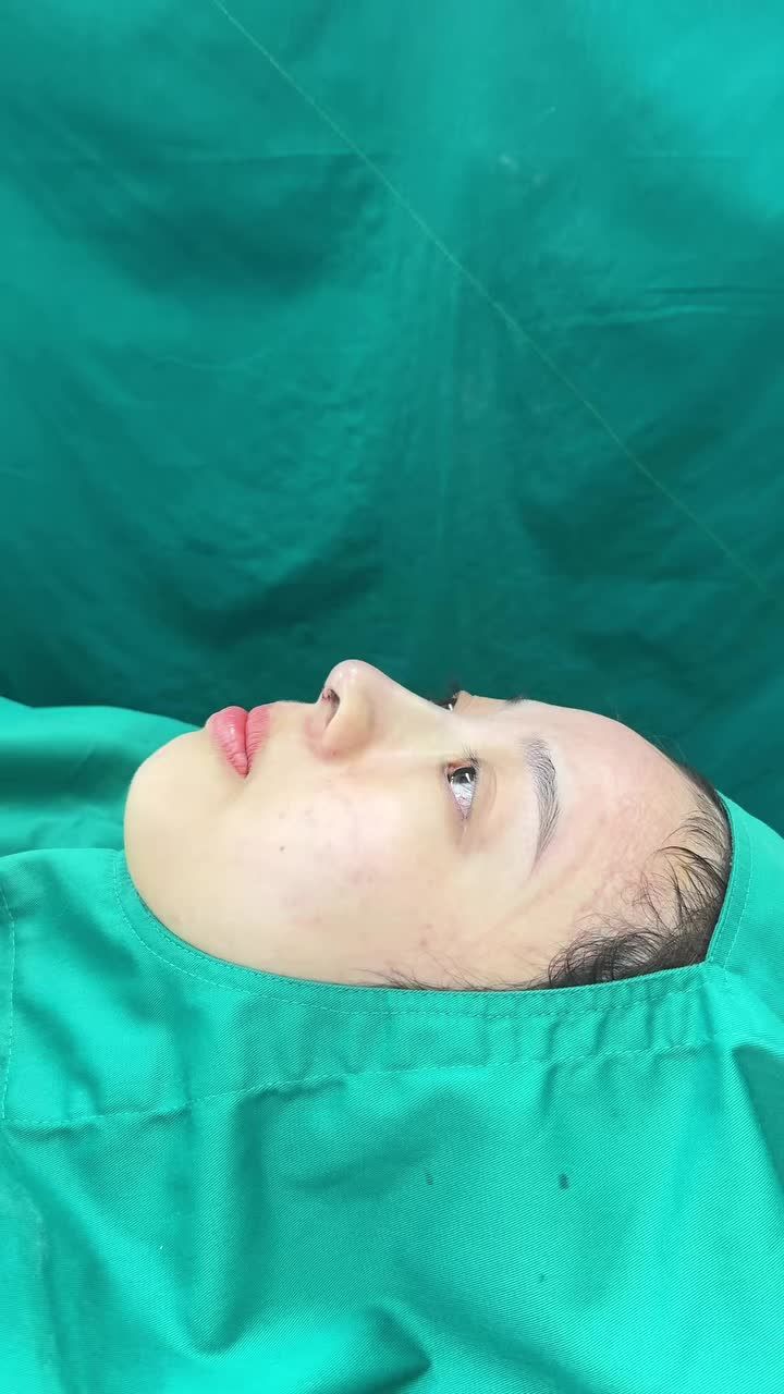 Case mũi cấu trúc vừa hoàn thành!!