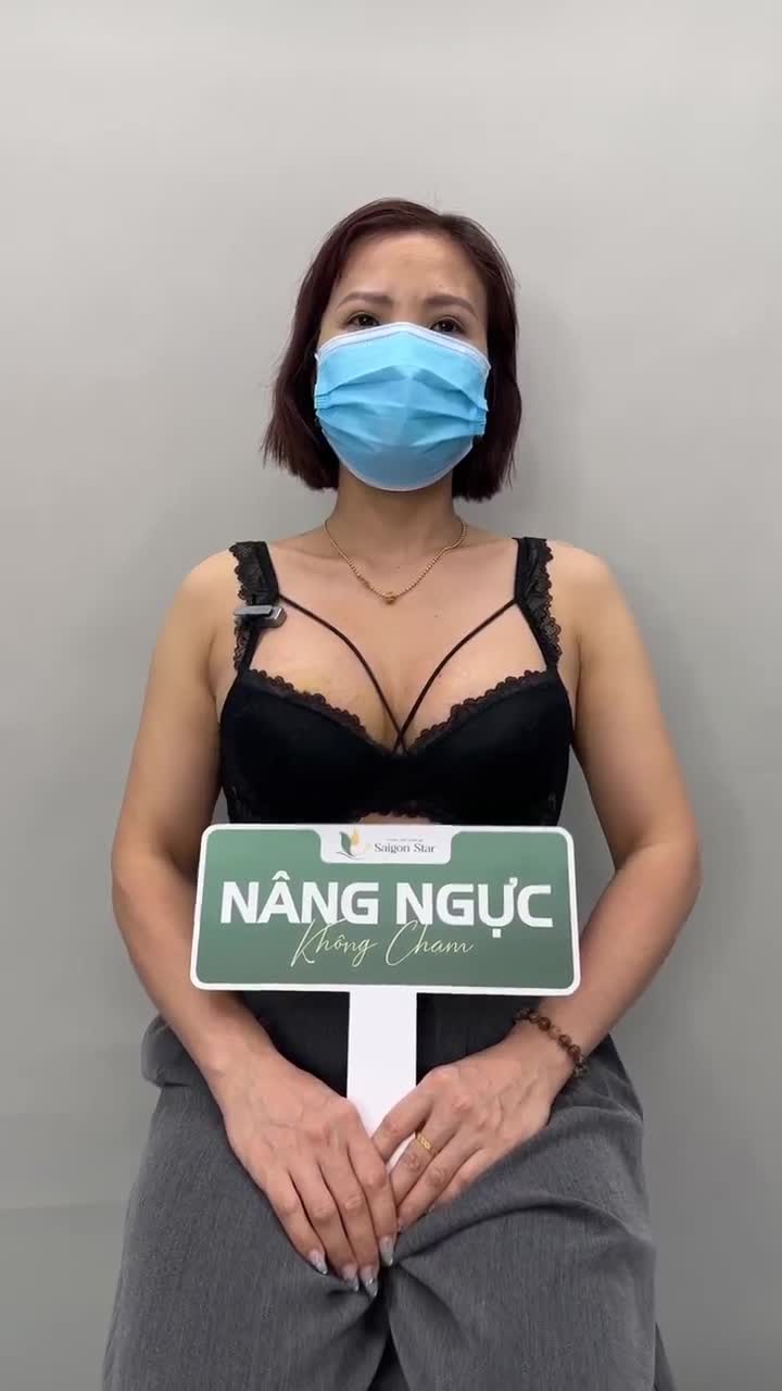 NÂNG CẤP VÒNG 1 SAU SINH