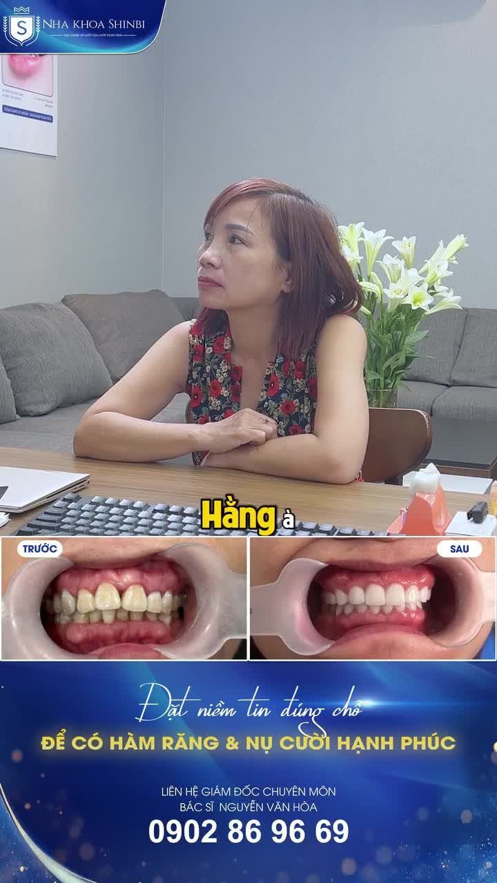 NHƯ TRẺ LẠI 10 TUỔI KHI CÓ HÀM RĂNG ƯNG Ý
