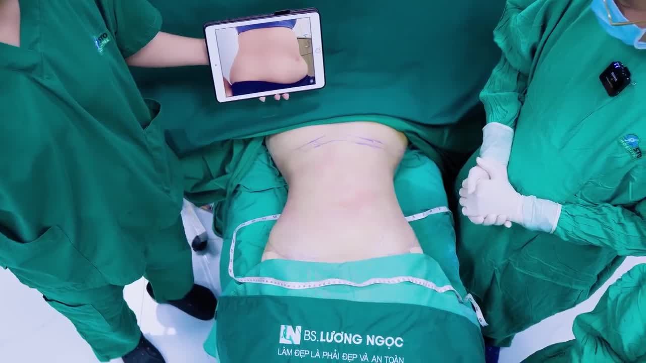 CHƯA TỪNG SINH CON – CÓ NÊN HÚT MỠ?