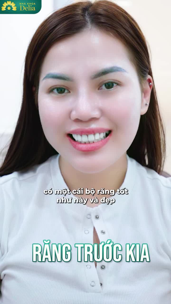 CHỊ RẤT HỐI HẬN KHI LÀM RĂNG SỨ 