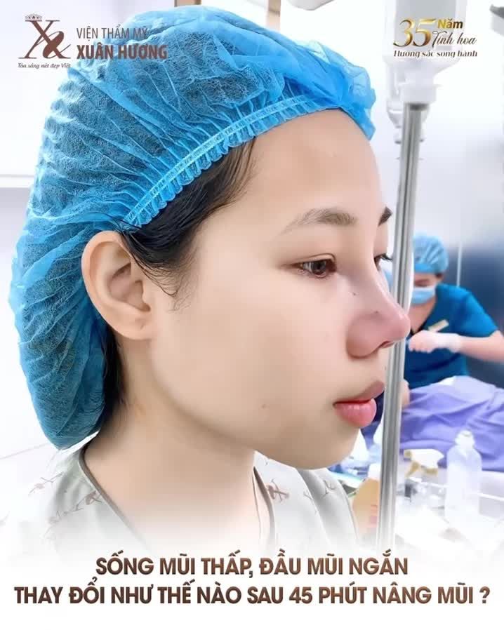 Chiếc mũi thay đổi cả vẻ ngoài – là đây chứ đâu!