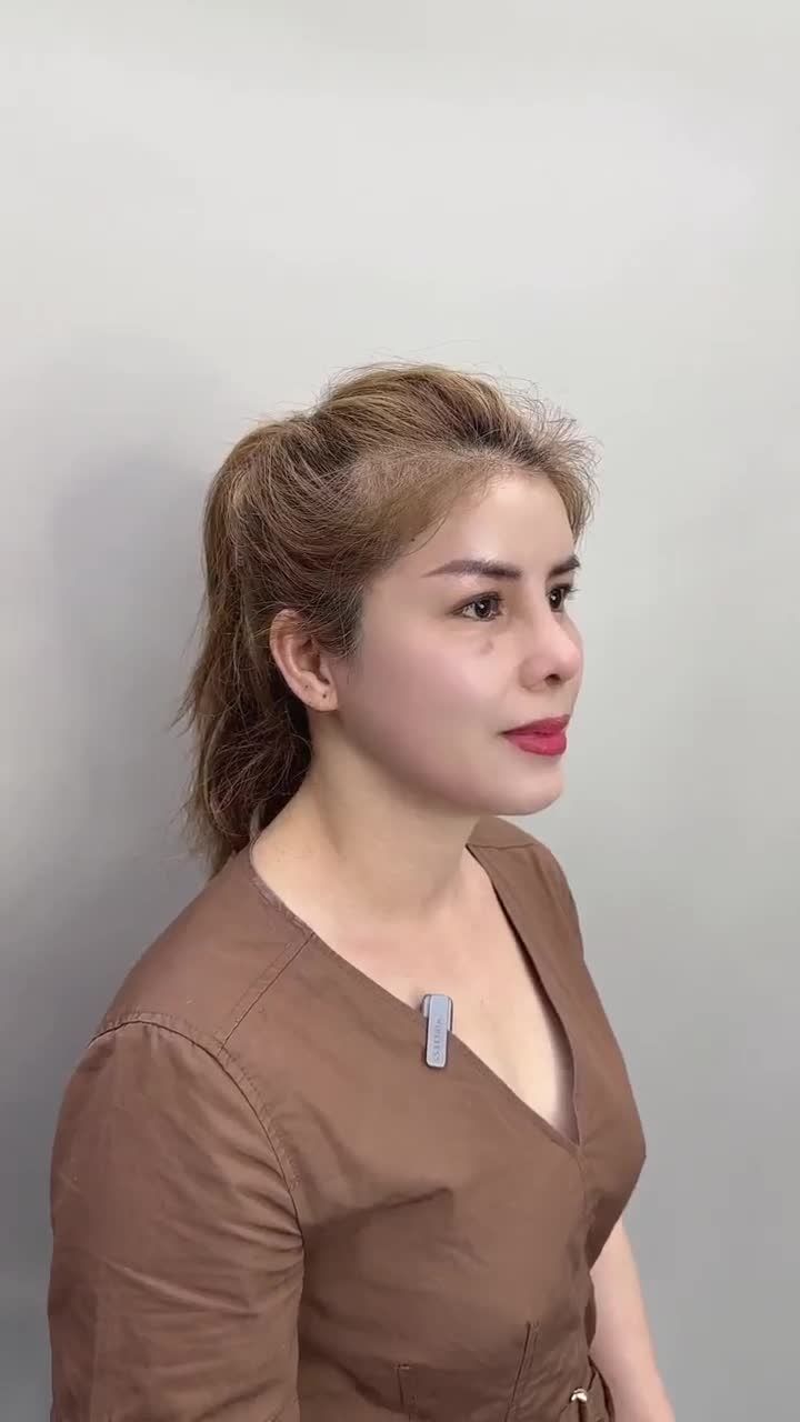 GẶP GỠ CHỊ KHÁCH VIỆT KIỀU ÚC SỞ HỮU NHAN SẮC TRẺ ĐẸP SAU 10 NGÀY THỰC HIỆN COMBO