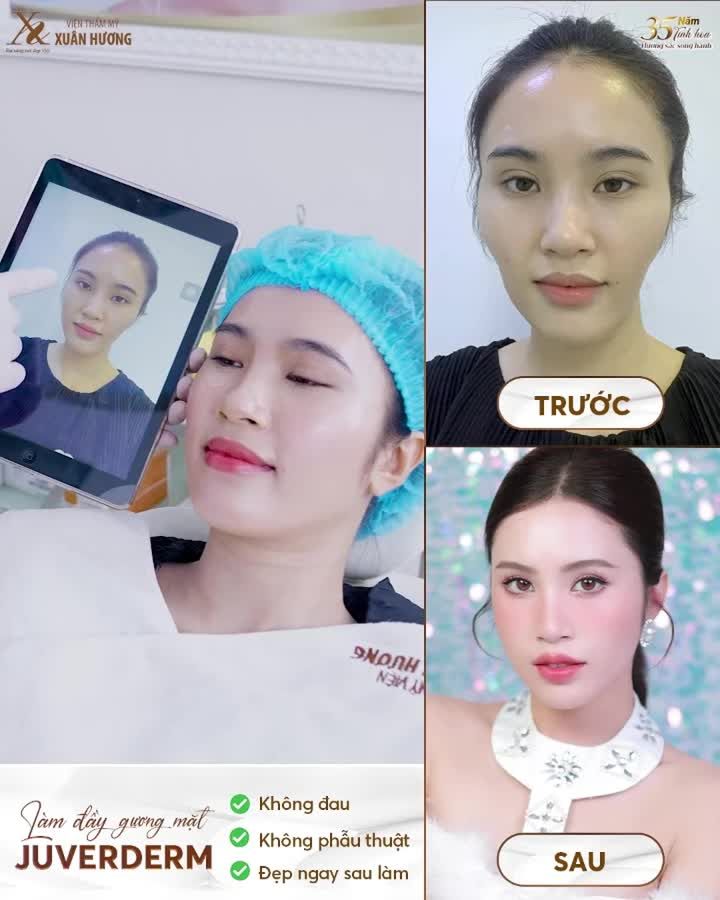 GƯƠNG MẶT TƯƠI TẮN CHỈ SAU 20 PHÚT – KHÔNG TRANG ĐIỂM VẪN TỰ TIN