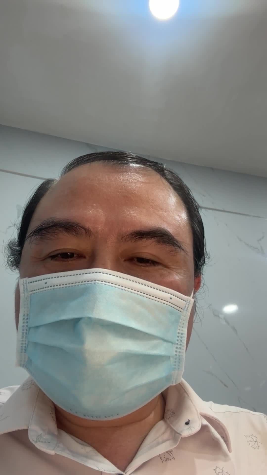 Kết quả hậu phẫu sau 10 ngay nâng mũi cấu trúc S-line với Dr Vương :