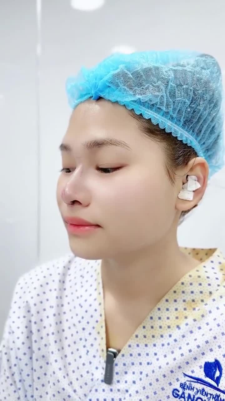 BẠN NỮ LỘT XÁC NHAN SẮC CHỈ SAU 60 PHÚT NÂNG MŨI TẠI GANGWHOO – DÁNG MŨI HÀI HÒA, GƯƠNG MẶT VƯƠN TẦM ĐẲNG CẤP!