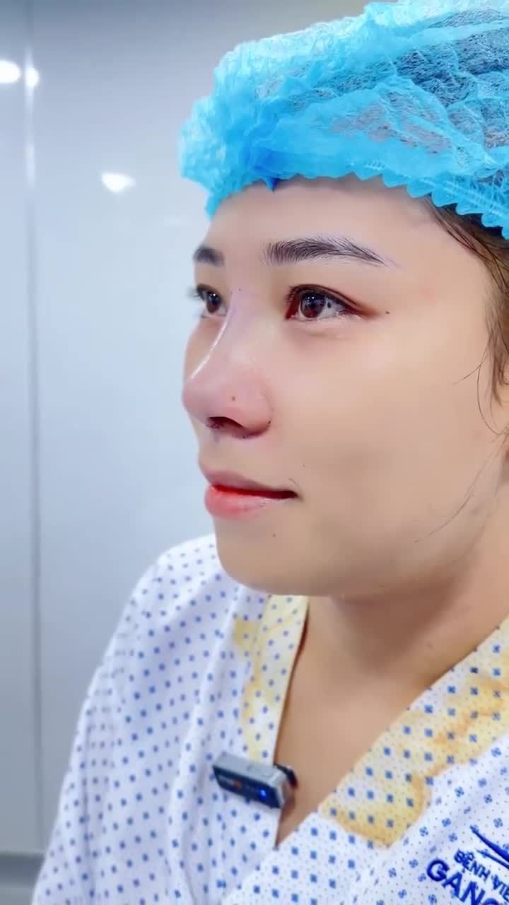 BẠN NỮ TRẺ TUỔI LỘT XÁC NHAN SẮC SAU 60 PHÚT NÂNG MŨI TẠI BỆNH VIỆN THẨM MỸ GANGWHOO – DÁNG MŨI THANH TÚ, GƯƠNG MẶT HÀI HÒA!