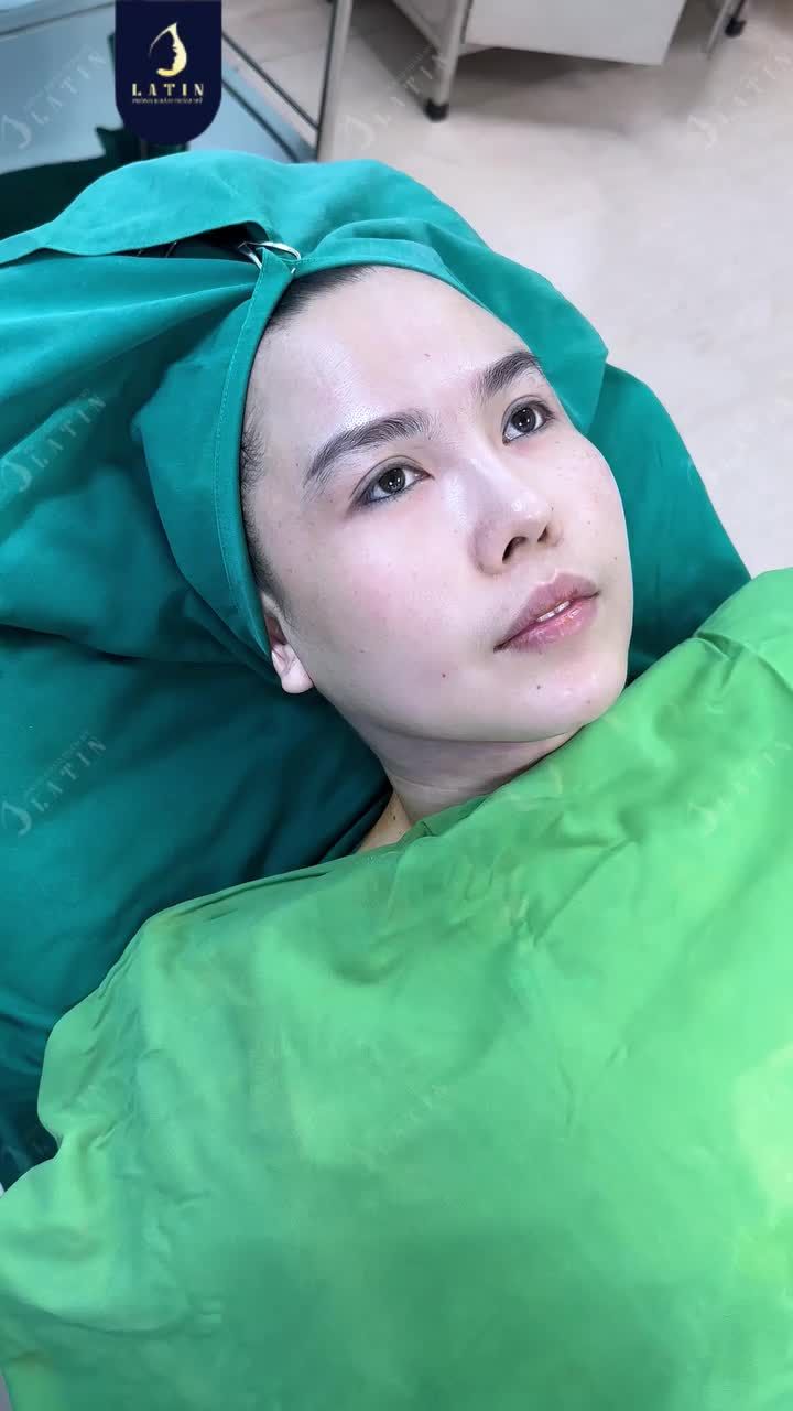 CẬN CẢNH CA ĐỘN THÁI DƯƠNG VÀ CẤY M.Ỡ TRẺ HÓA GƯƠNG MẶT