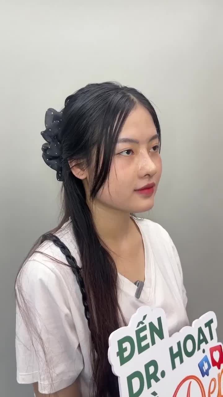 KẾT QUẢ SAU 10 NGÀY NÂNG MŨI CẤU TRÚC CHO KHÁCH HÀNG GEN Z