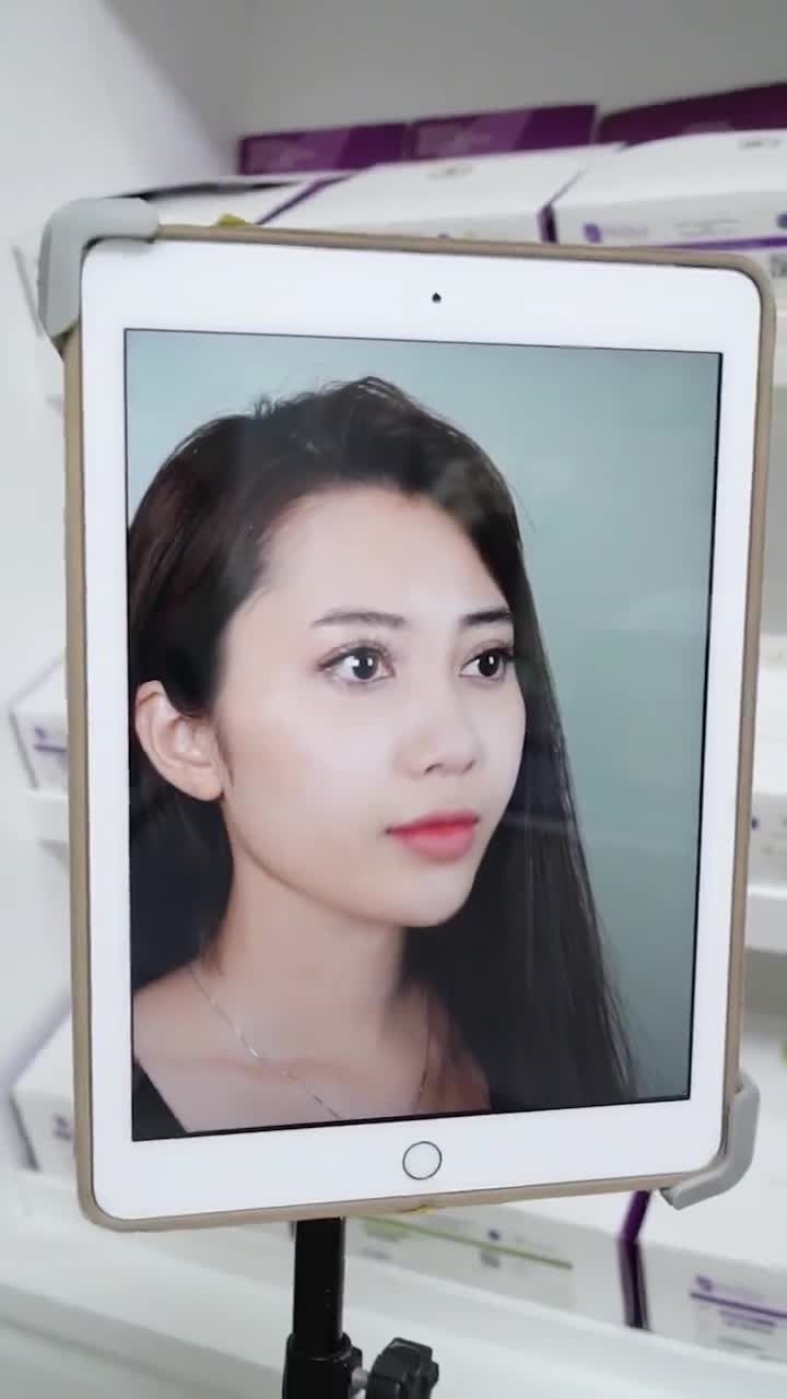 SIÊU PHẨM NÂNG MŨI CẤU TRÚC CHO KHÁCH HÀNG SAU 10 NGÀY