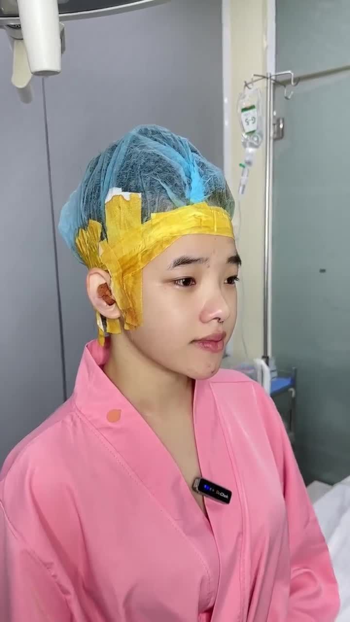 HOÀN THÀNH CASE NÂNG MŨI CẤU TRÚC CHO BẠN KHÁCH 2K6