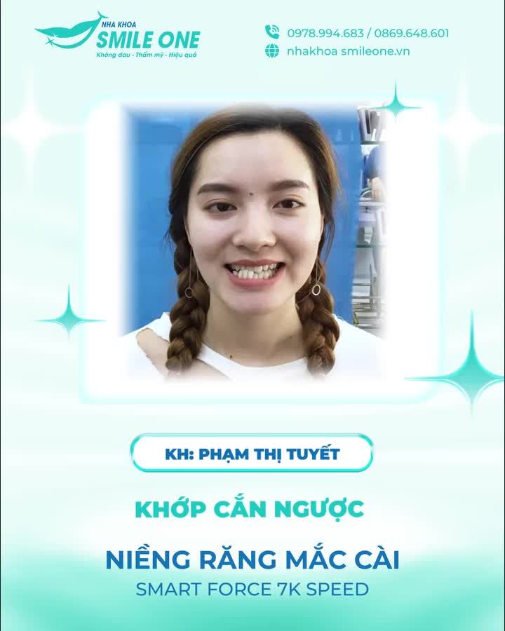 Niềng răng là cả một hành trình, và người niềng răng thực sự là một siêu nhân!