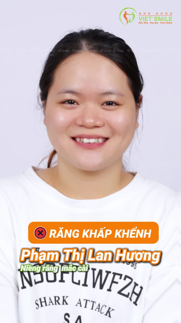Cùng Viet Smile đi kiểm chứng ngay nhé!