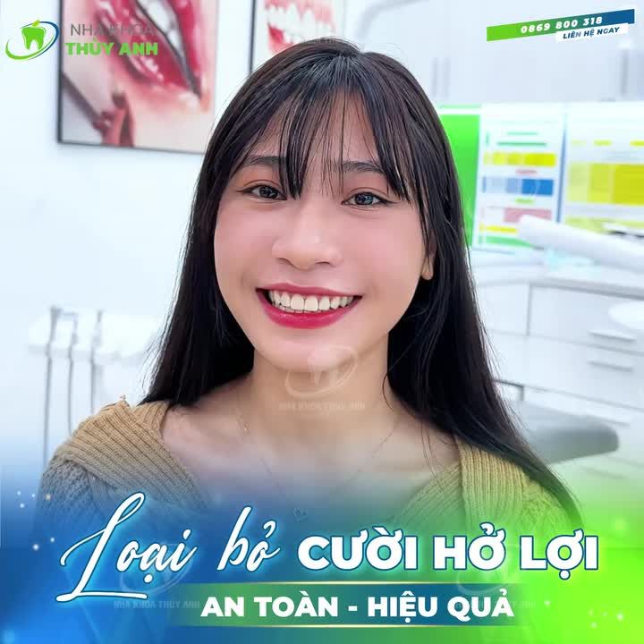 TẠM BIỆT NỤ CƯỜI HỞ LỢI, RẠNG RỠ CHỈ SAU 45 PHÚT TẠI NHA KHOA THÙY ANH