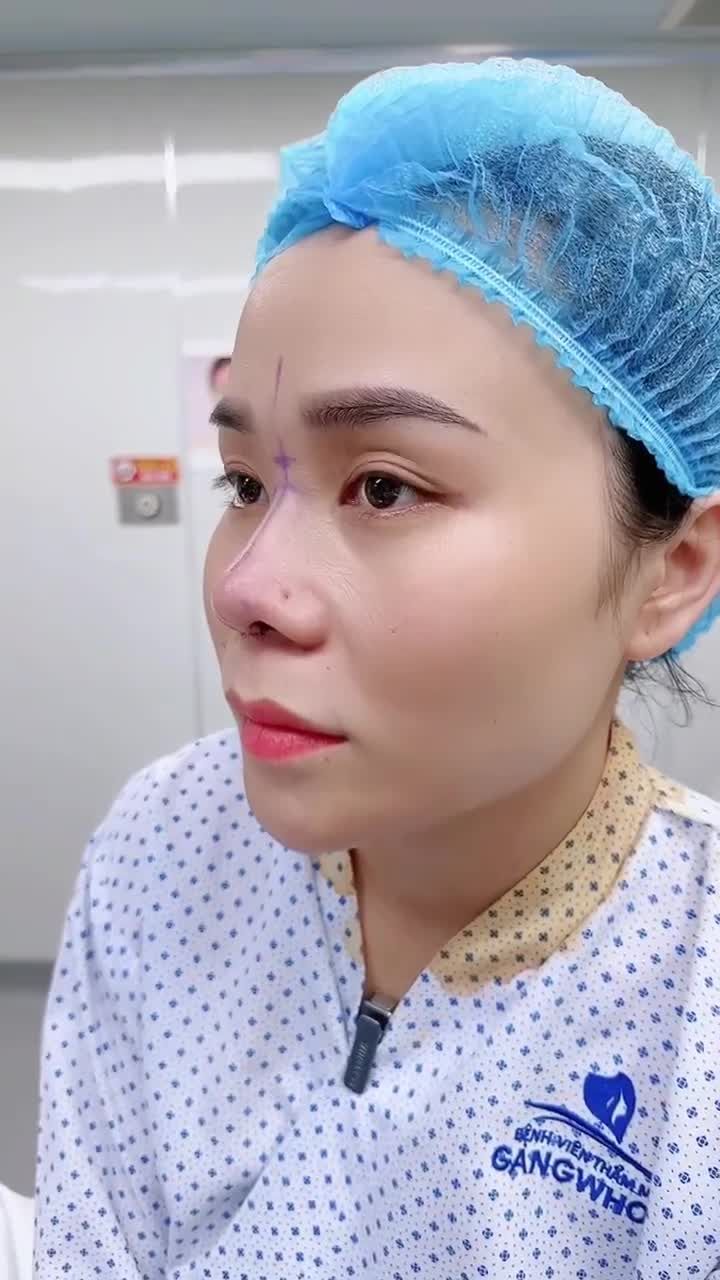 CHỊ T.M. LỘT XÁC VỚI NÂNG MŨI CẤU TRÚC 3D TẠI GANGWHOO – DÁNG MŨI THANH TÚ, DIỆN MẠO NỔI BẬT!