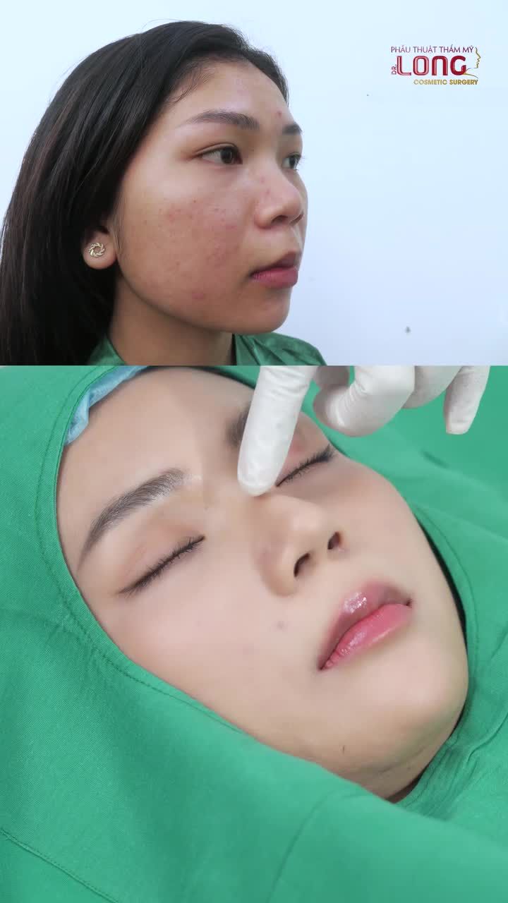 Lấy cây kim may đồ....Nhìn mình sau nâng em đây cũng xinh hơn nhiều cô.
